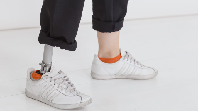 工具機結合AI,量身訂做高CP值的義肢!